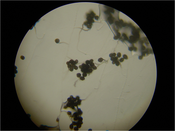 Ulocladium conidiophores magnified 40X